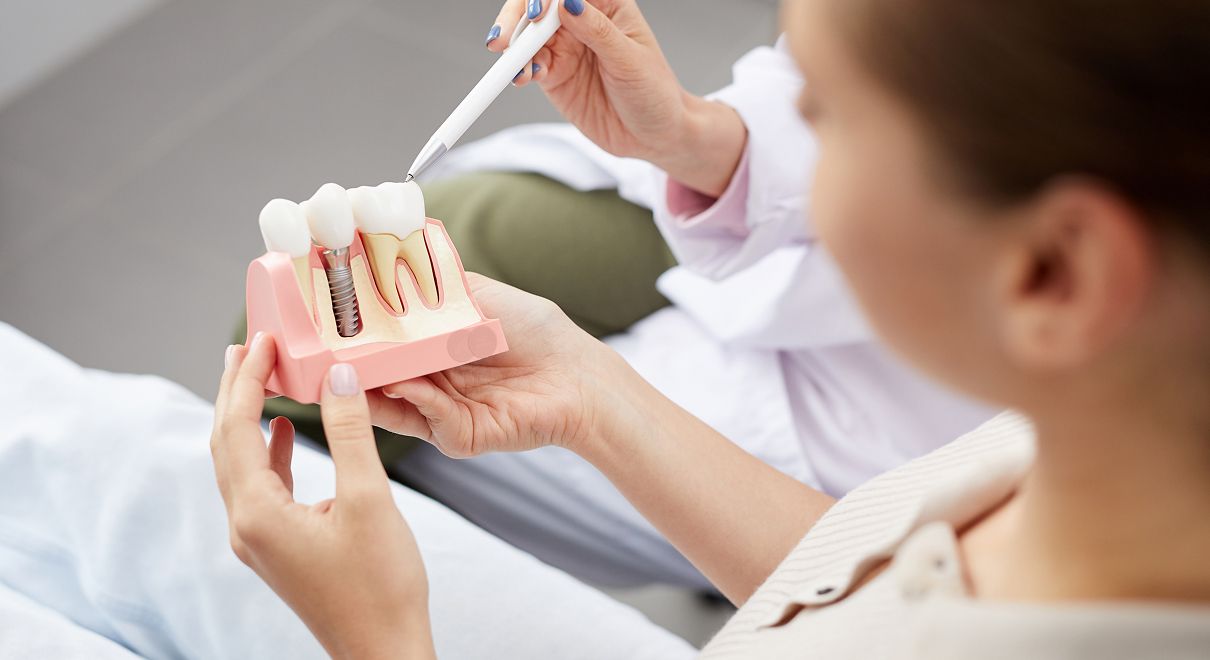 Implant dentaire Dentistes à Camblanes-et-Meynac, Cab﻿inet dentaire des Vignes