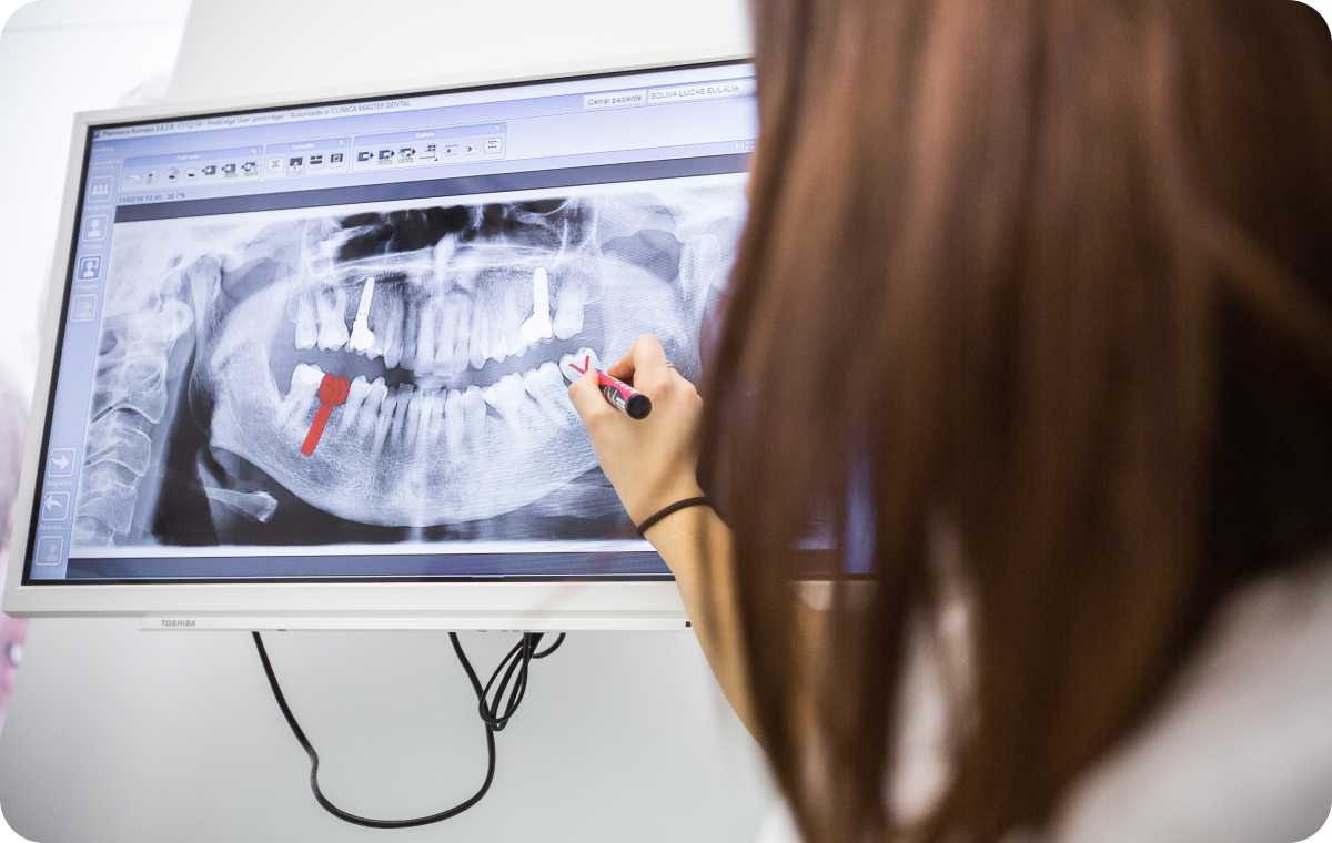 Implant dentaire Dentistes à Camblanes-et-Meynac, Cab﻿inet dentaire des Vignes