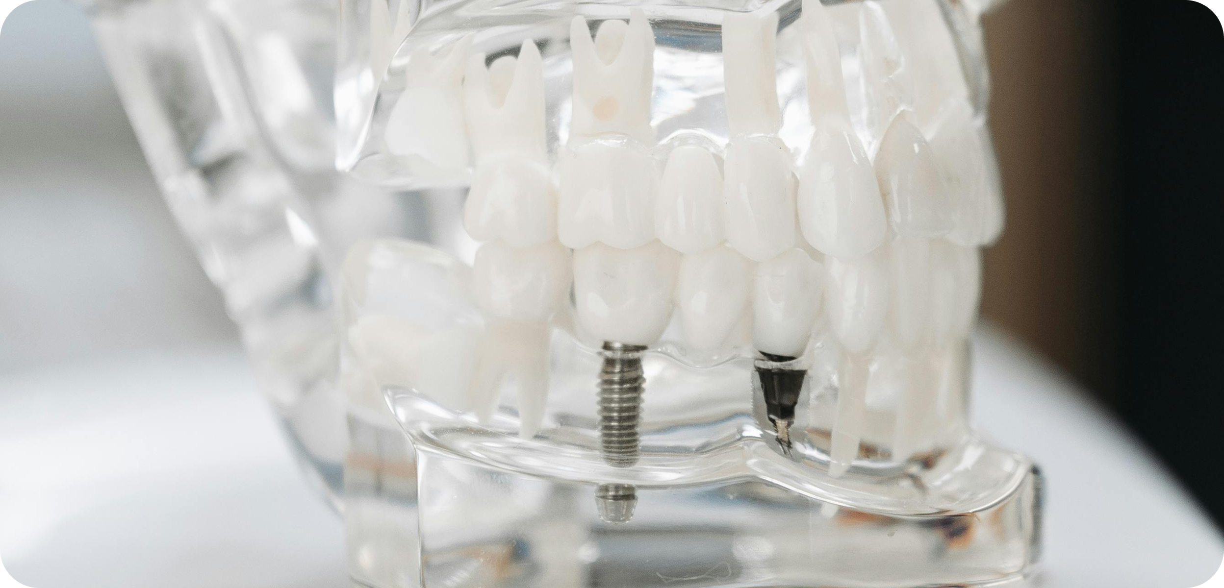 Dentistes à Camblanes-et-Meynac, Cab﻿inet dentaire des Vignes