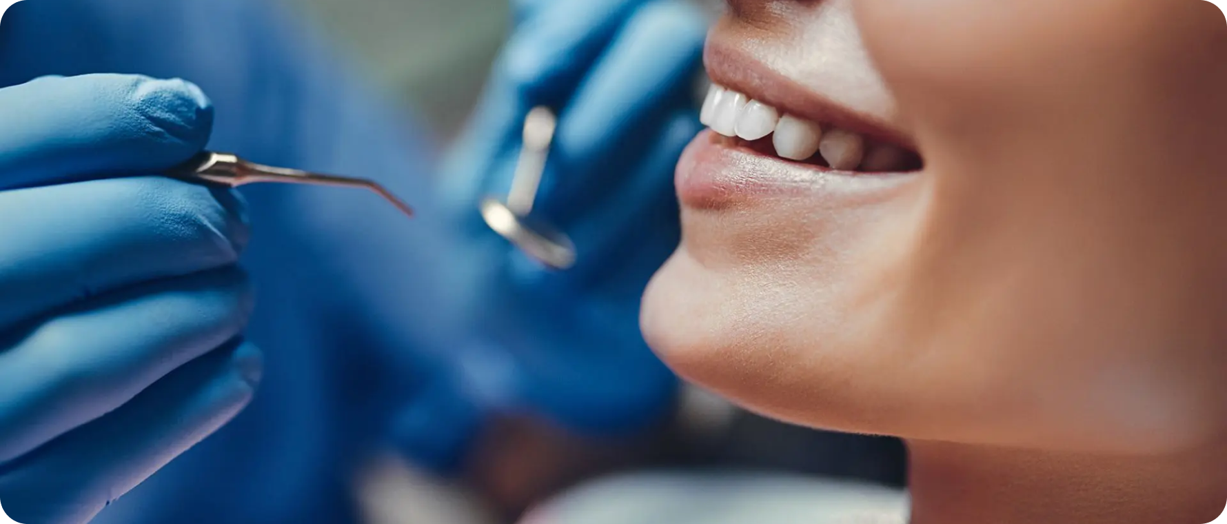 Frénectomie Dentistes à Camblanes-et-Meynac, Cab﻿inet dentaire des Vignes