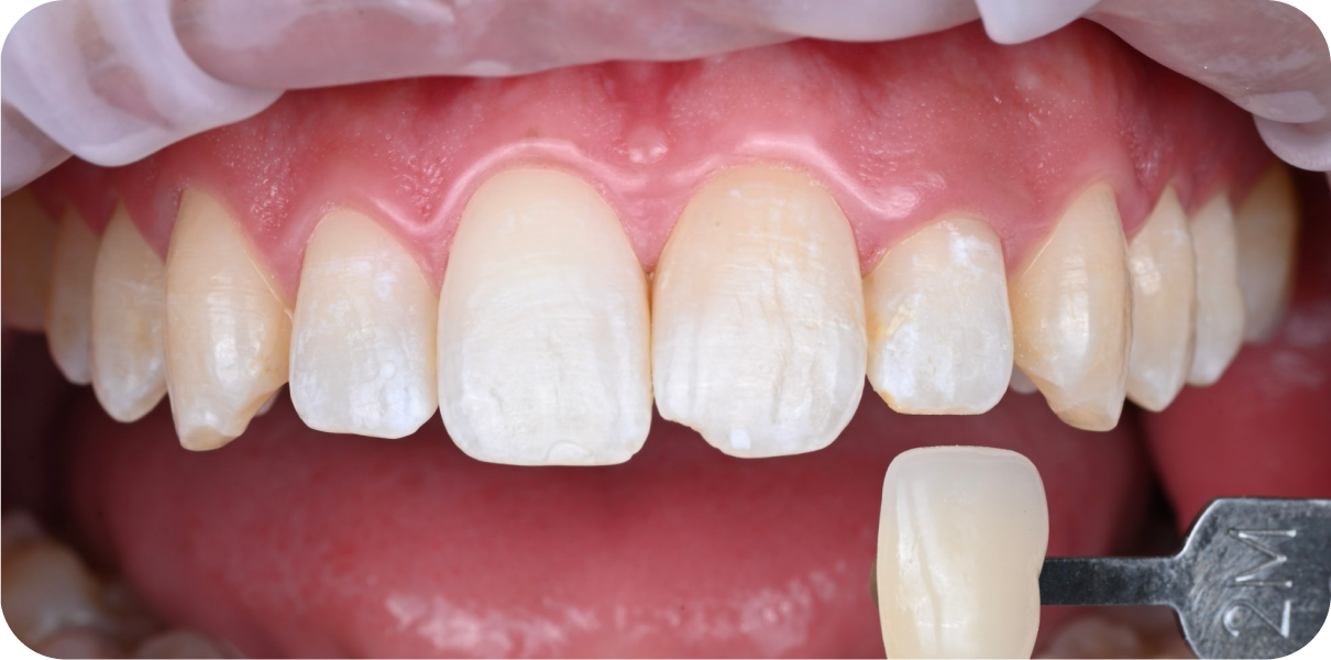 Processed - Man holding beer