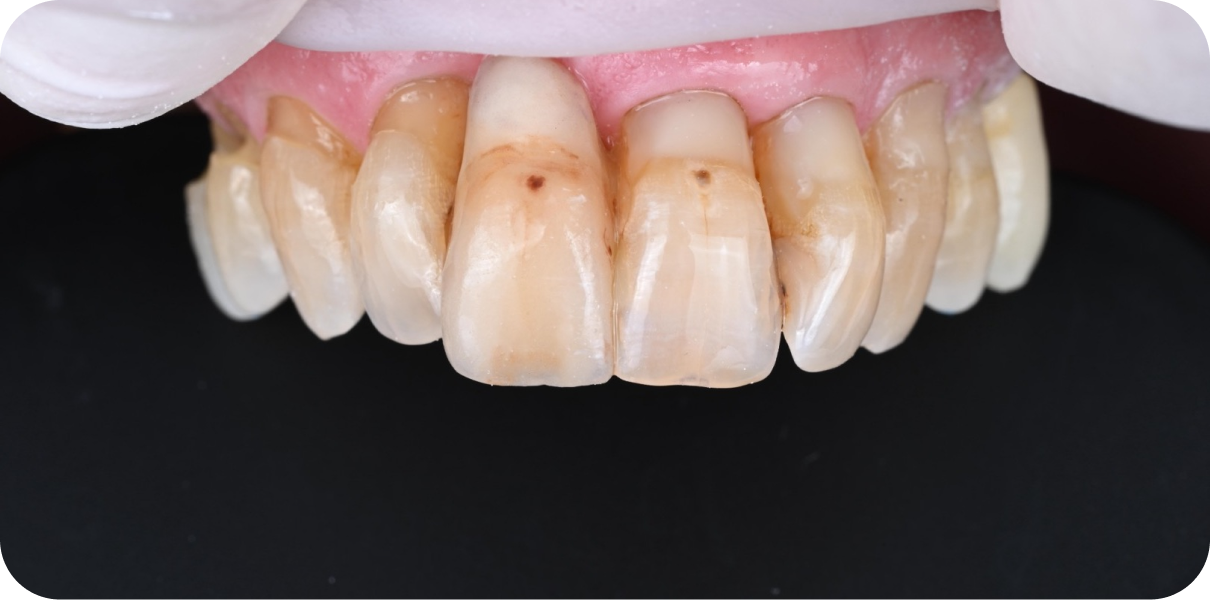 Processed - Man holding beer