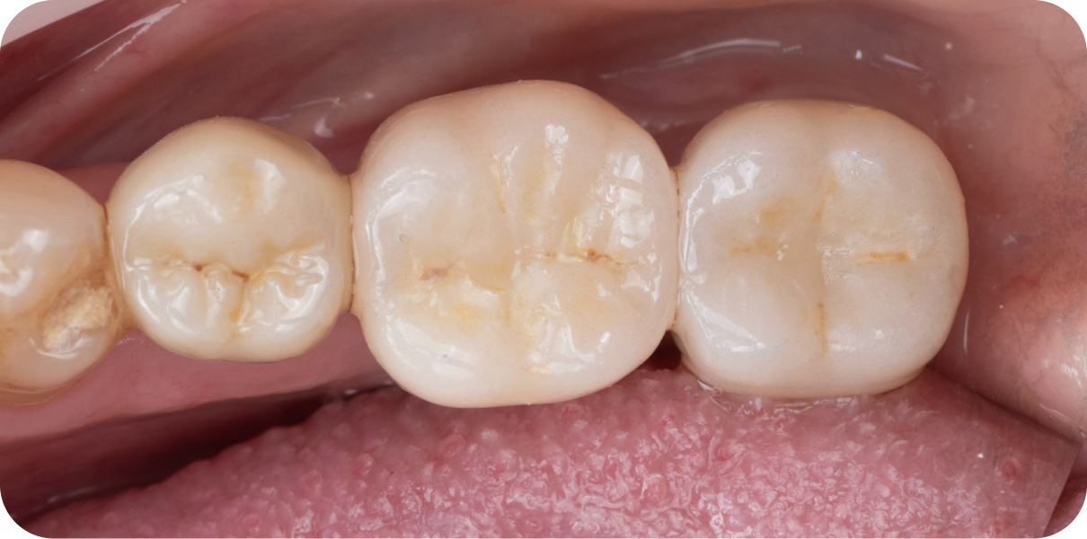 Processed - Man holding beer