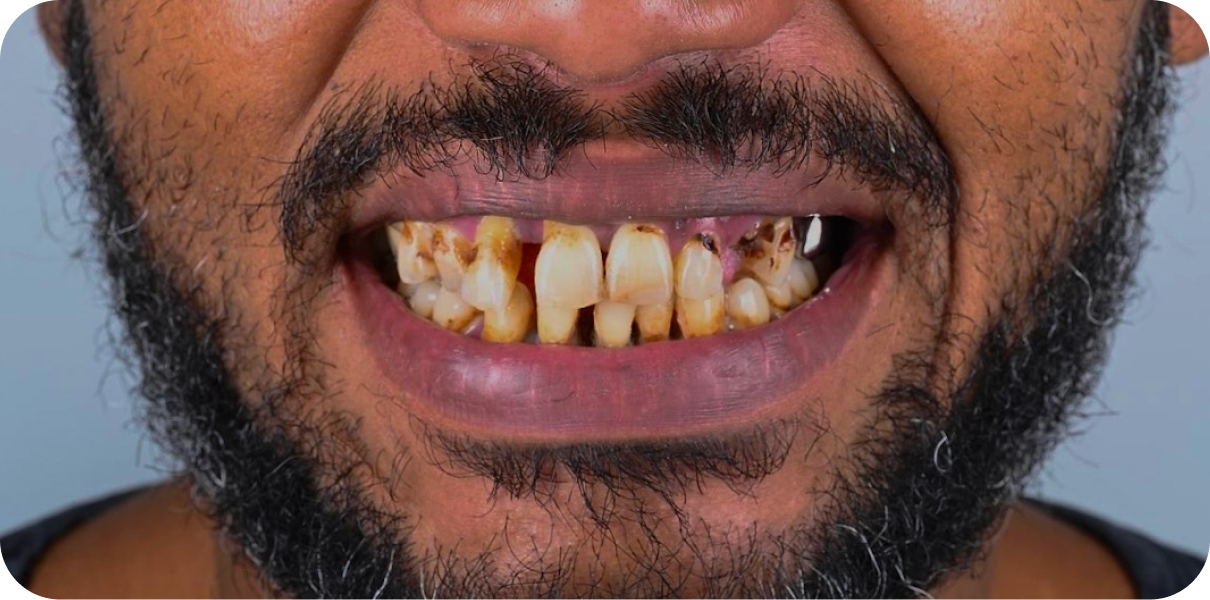 Original - Man holding beer