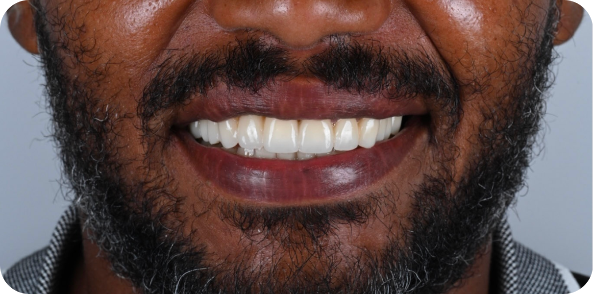 Processed - Man holding beer