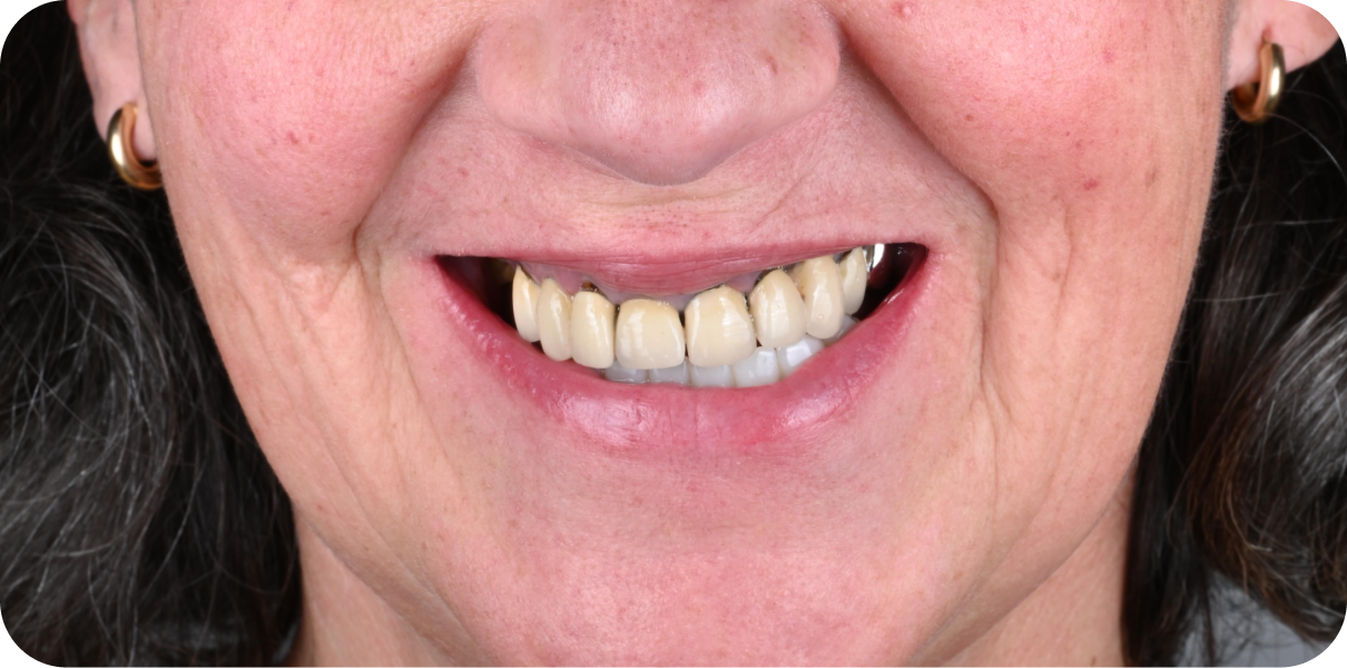 Original - Man holding beer