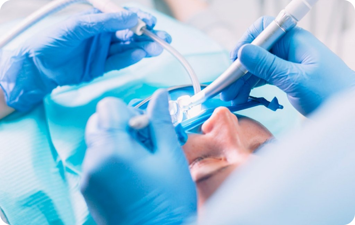 Conseils post-opératoires Dentistes à Camblanes-et-Meynac, Cab﻿inet dentaire des Vignes