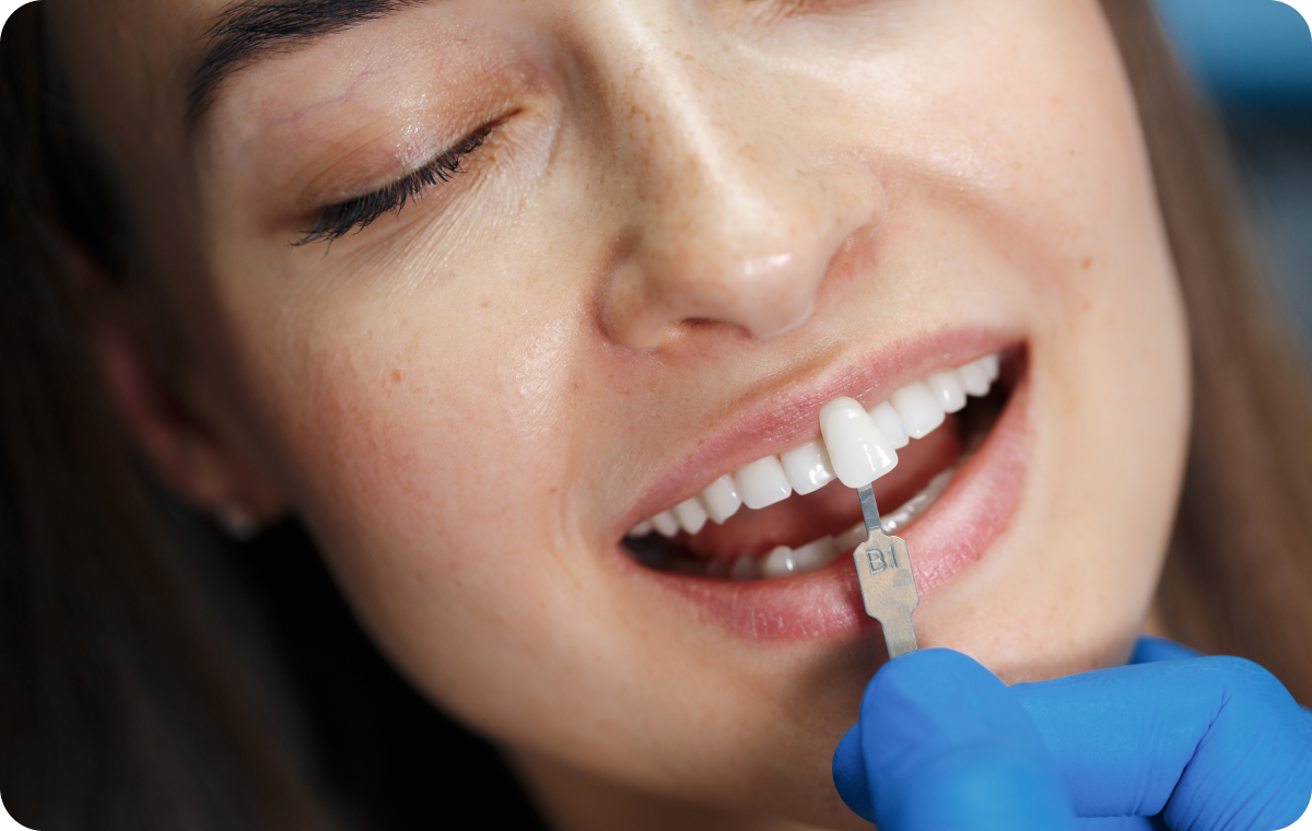 Facettes dentaires Dentistes à Camblanes-et-Meynac, Cab﻿inet dentaire des Vignes
