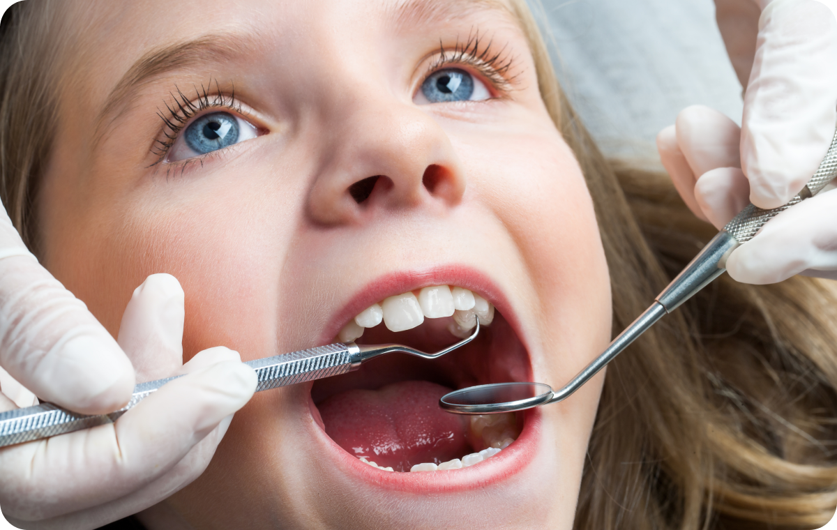 Traumatismes dentaires de l’enfant Dentistes à Camblanes-et-Meynac, Cab﻿inet dentaire des Vignes